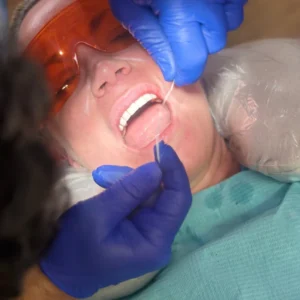 Experience Gentle, Stress-Free Dental Care in Fortitude Valley