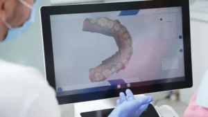 The Latest Technology in Dental Crowns