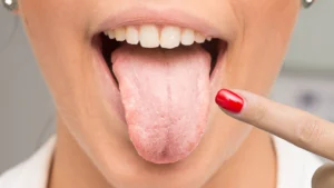 What Your Tongue Can Reveal About Your Health
