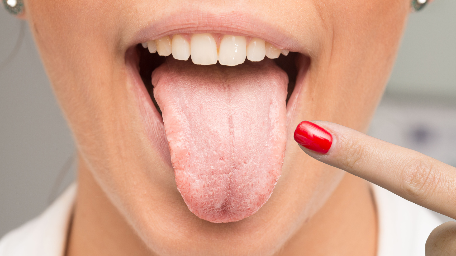 What Your Tongue Can Reveal About Your Health