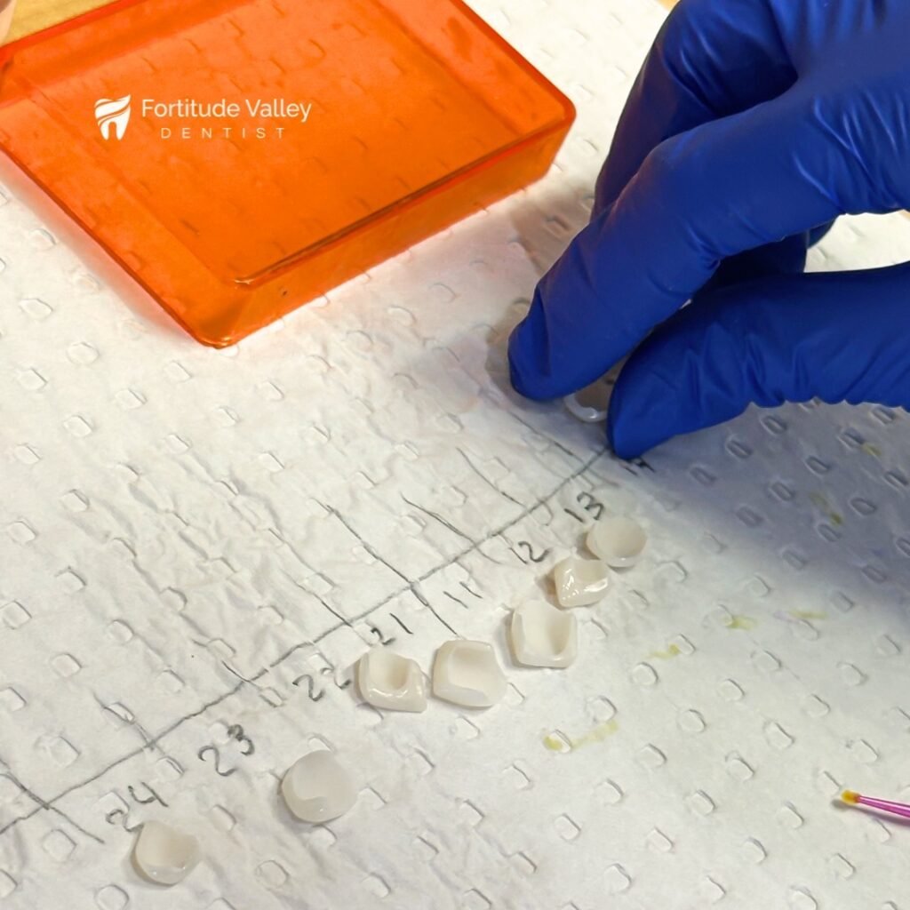Choosing Your Cosmetic Crown Material