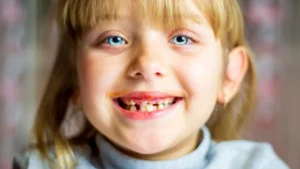 Myofunctional Therapy: The Secret to Better Breathing, Better Sleep, and a Healthier Smile