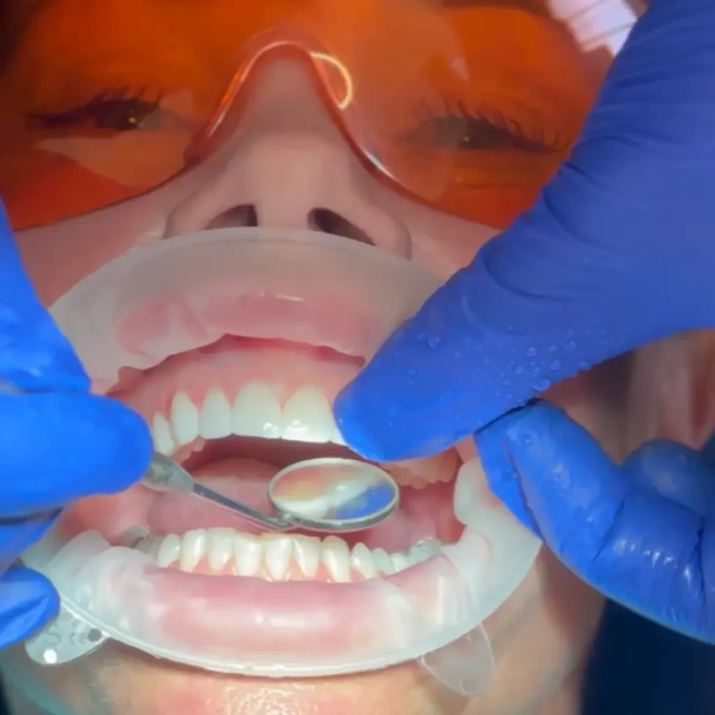 Cosmetic Dentistry Trends 2025: What Brisbane Patients Are Asking For