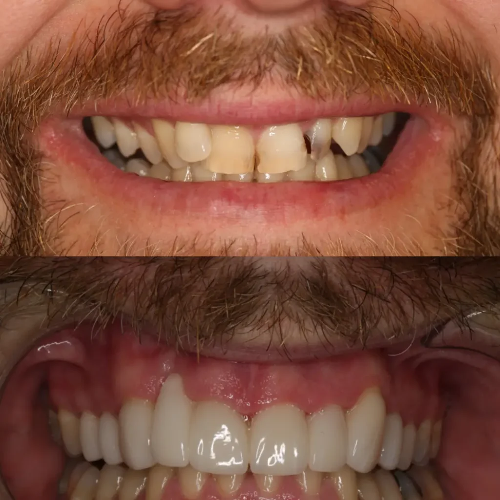 Cosmetic Dentistry Trends 2025: What Brisbane Patients Are Asking For