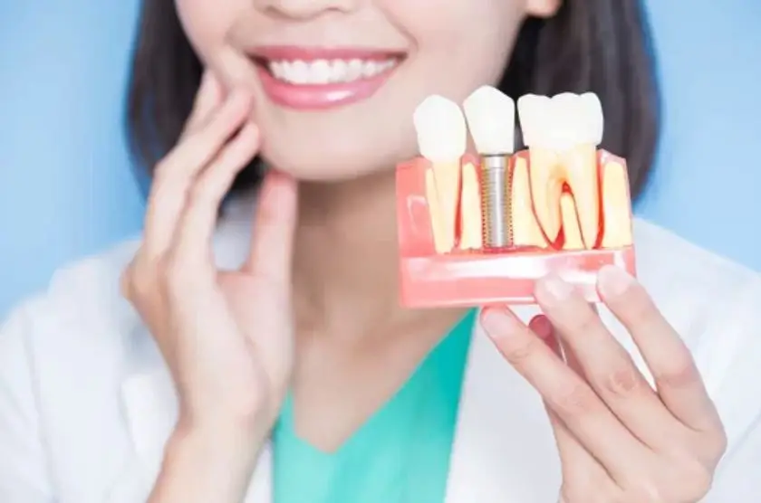 Dental Implants Brisbane